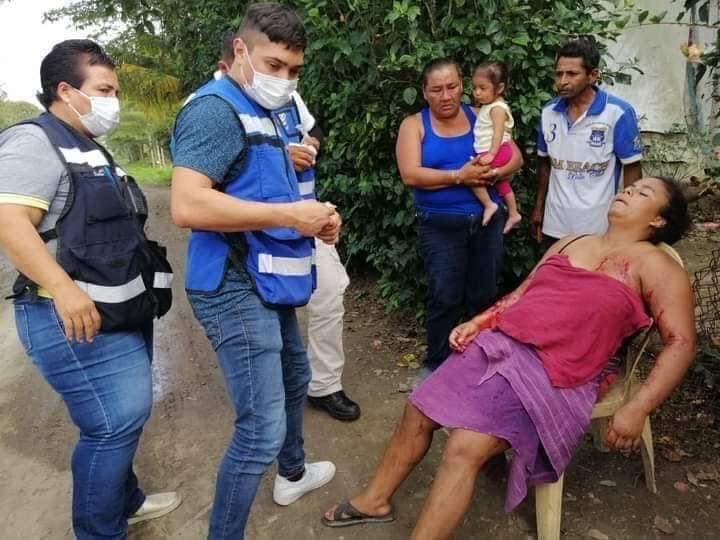 Pitbull ataca a su dueña y deciden sacrificarlo