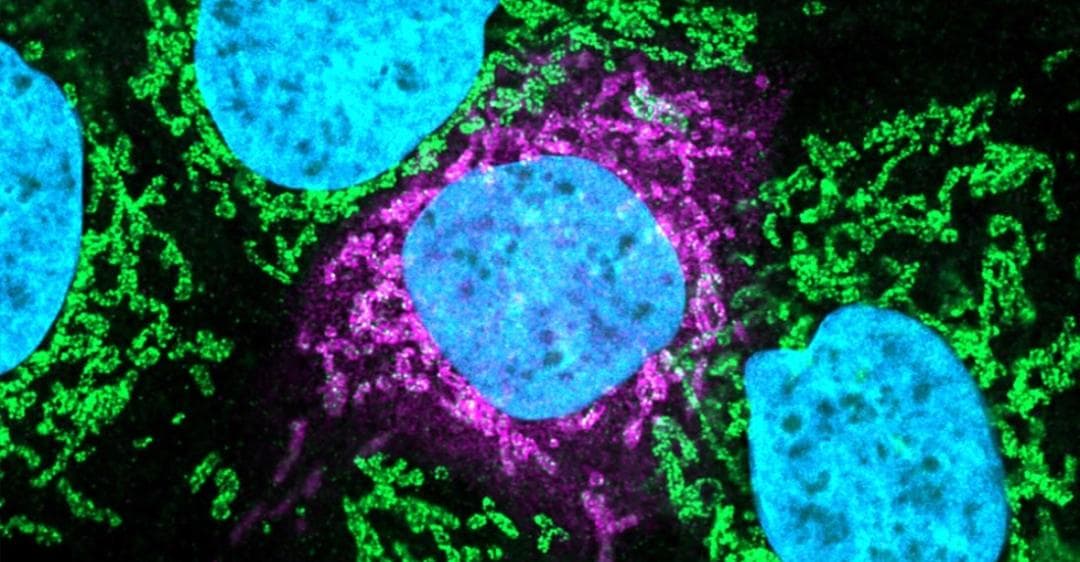 Una nueva variante británica del Covid-19 ha sido detectada en 9 países