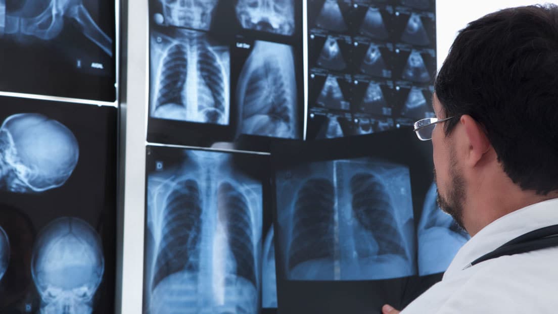 Niño británico es operado tras ingerir más de 50 imanes