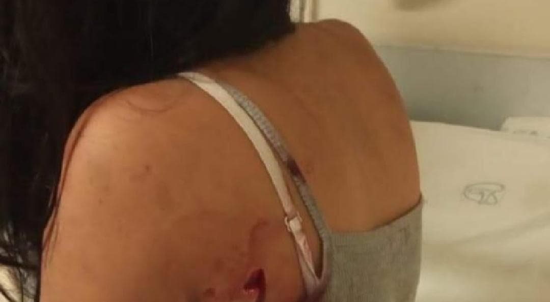 Lleva 10 años siendo agredida por su ex pareja; esta vez fue macheteada