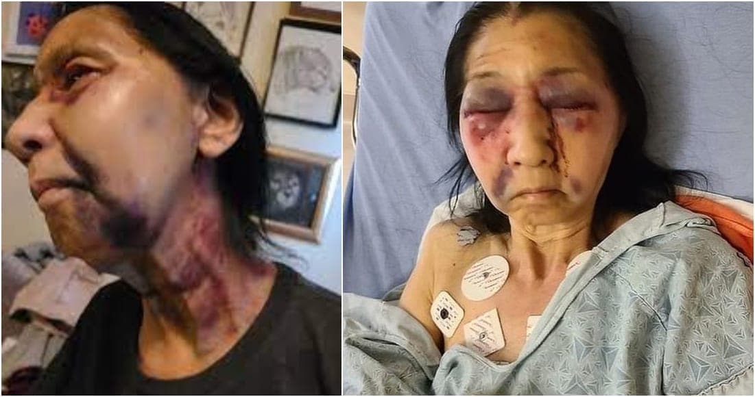 FOTOS: Racista de 23 años en EU casi mata a golpes a una abuela mexicoamericana. Creyó era asiática