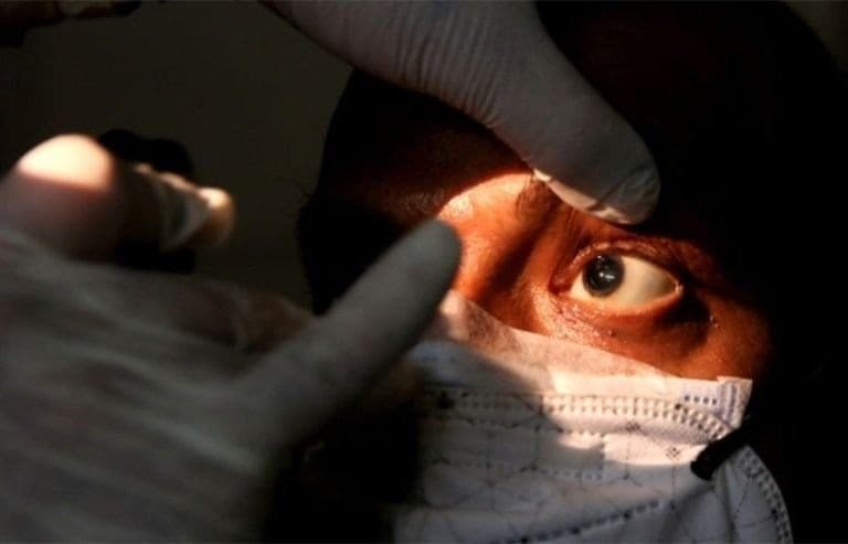 Confirman la primera víctima de muerte por “hongo negro” en Argentina