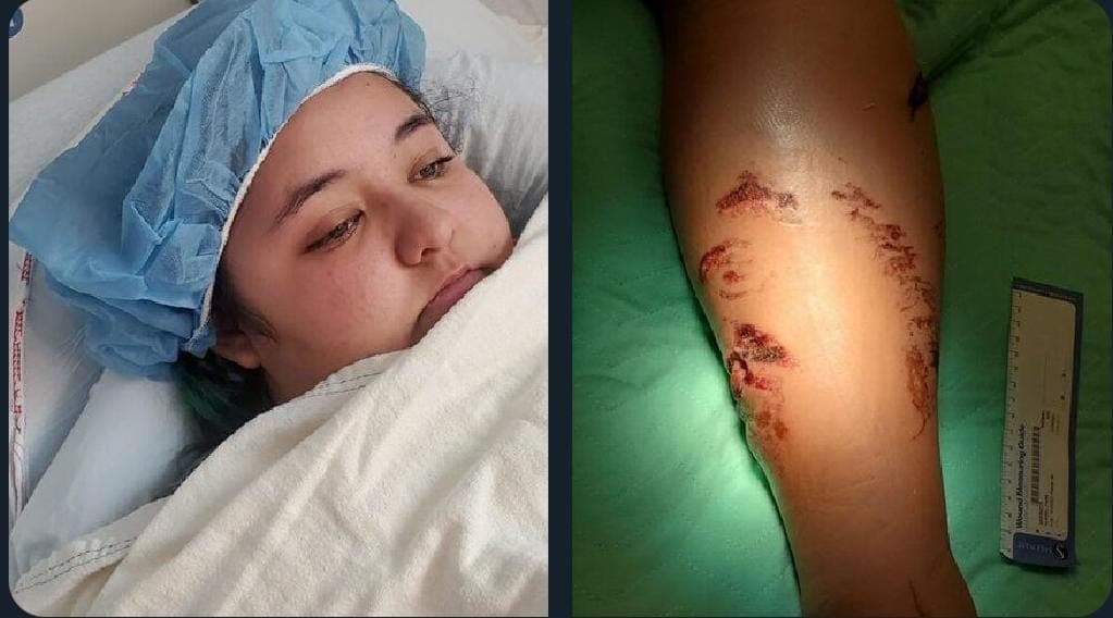 Cocodrilo ataca a joven en el Marriott Puerto Vallarta