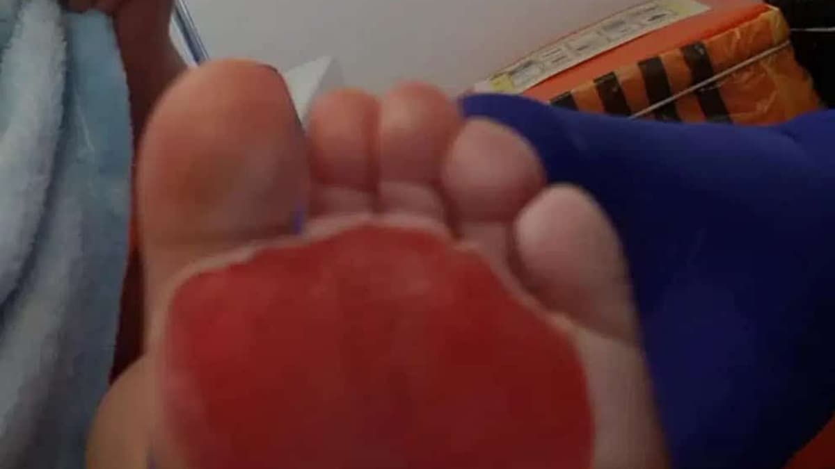 Bebé se quema la piel de los pies en el piso de la cocina  por la ola de calor en Inglaterra