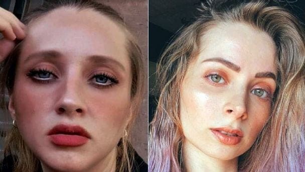 Sobrina de Yoseline Hoffman corrige al hermano de YosStop: “La justicia no funciona de esa forma”