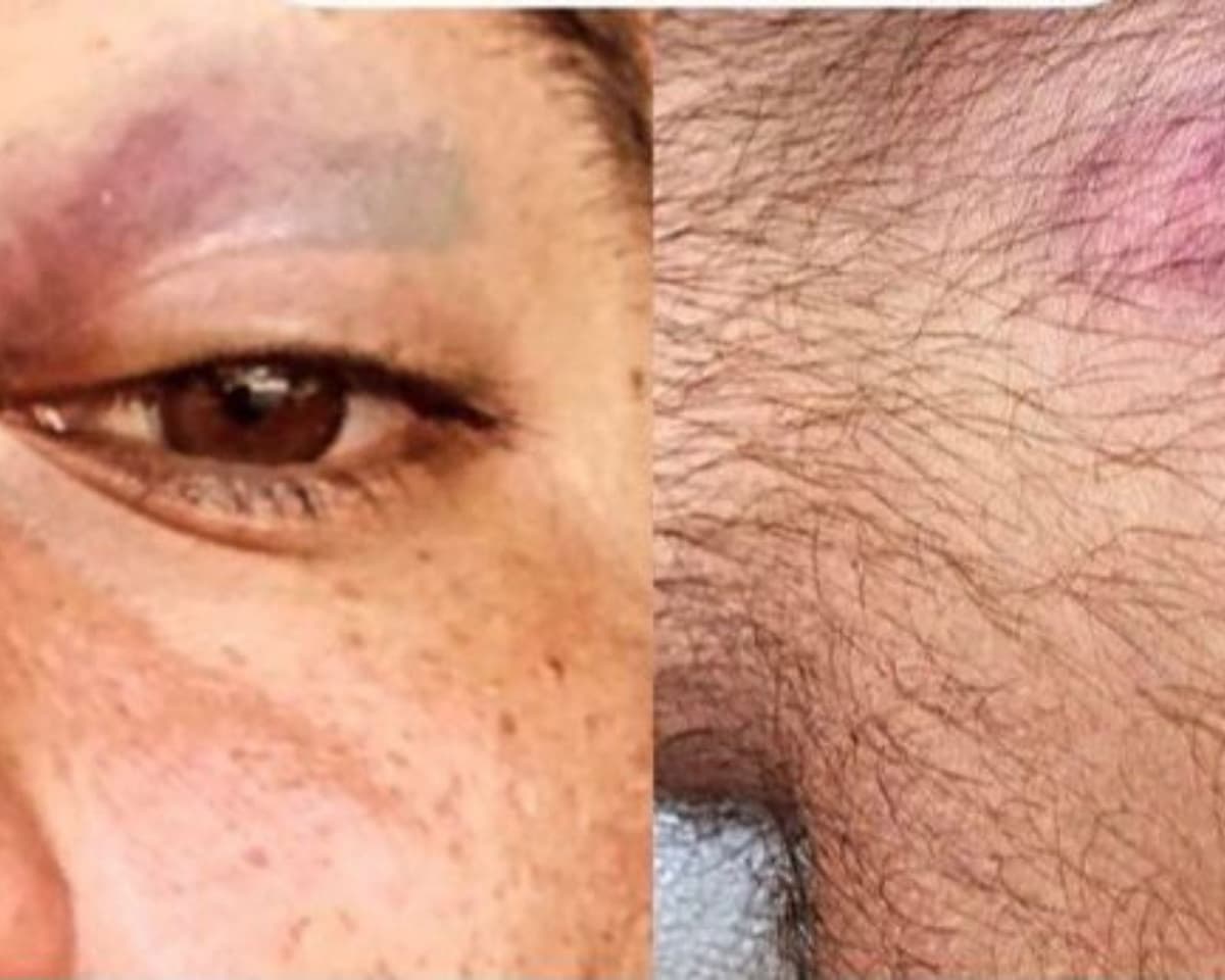 Denuncia pareja gay ser golpeada por salir agarrados de la mano de un antro en Chihuahua