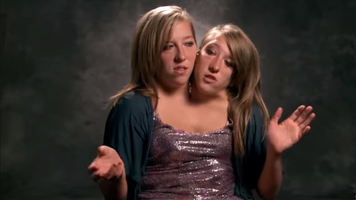 Famosas siamesas de Discovery Channel visitan Mahahual