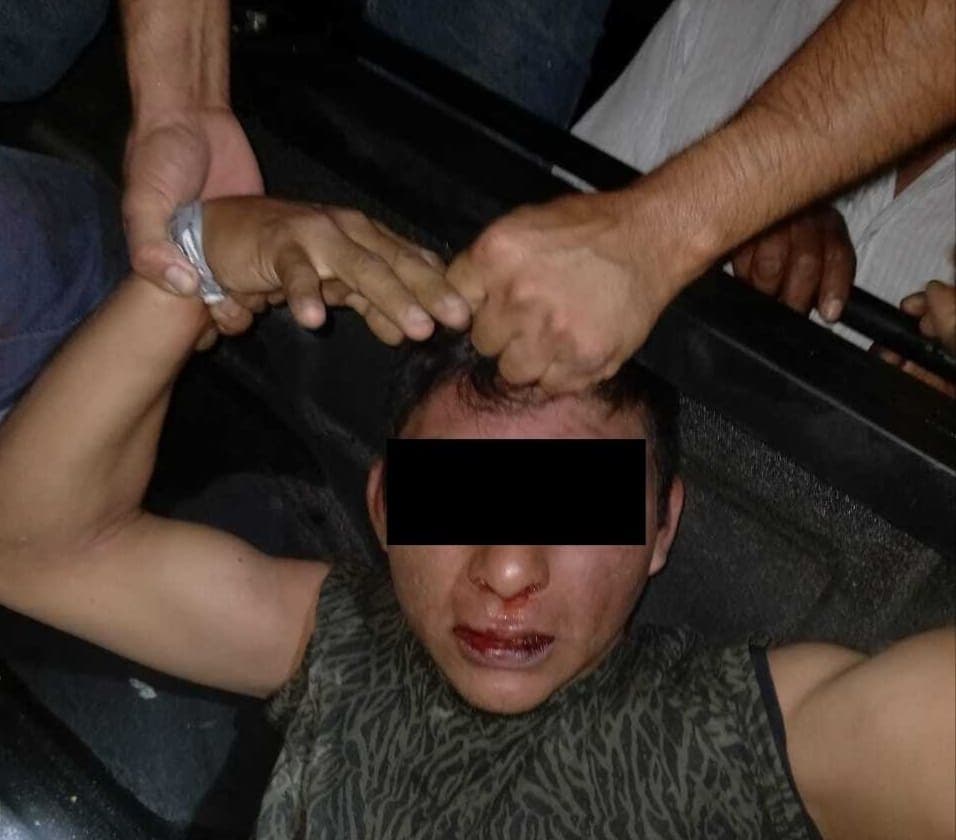 INDIGNANTE: Muere joven atropellado por militares en presunto estado de ebriedad