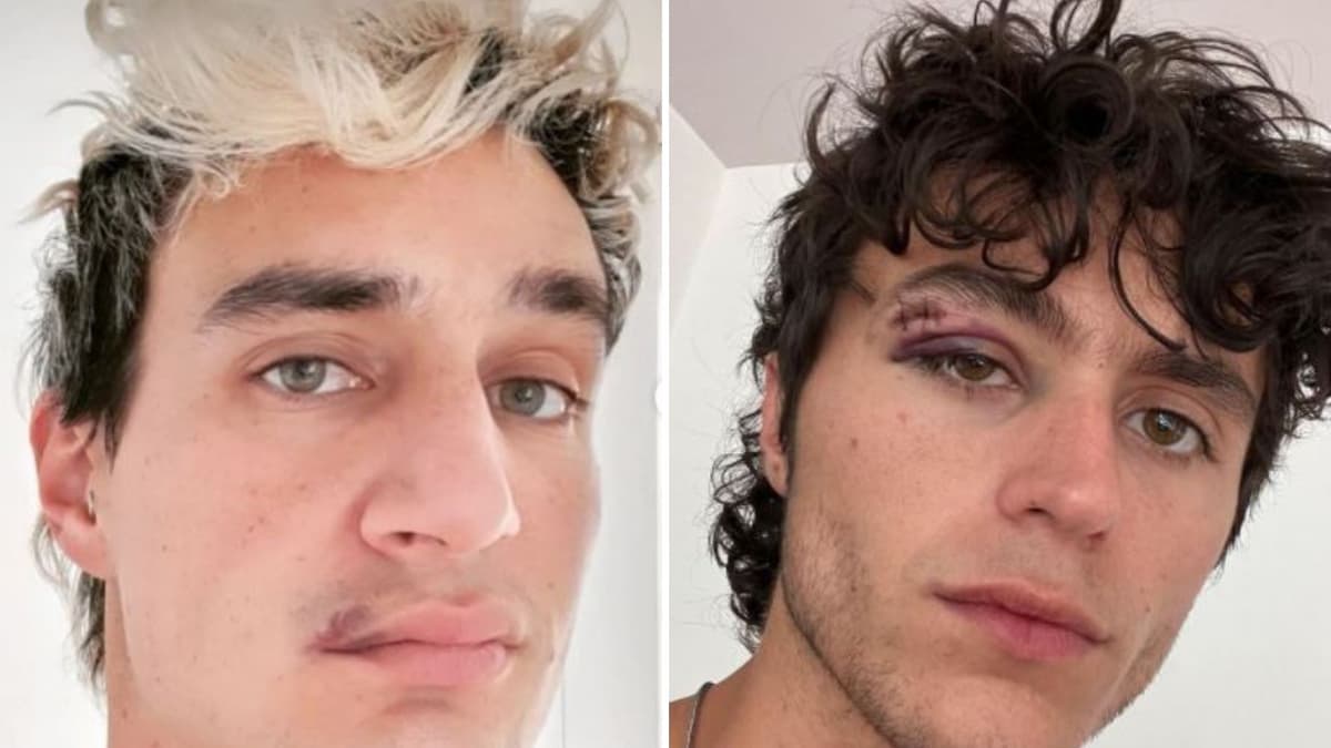 Cliente golpea a pareja LGBT en una taquería de la CDMX