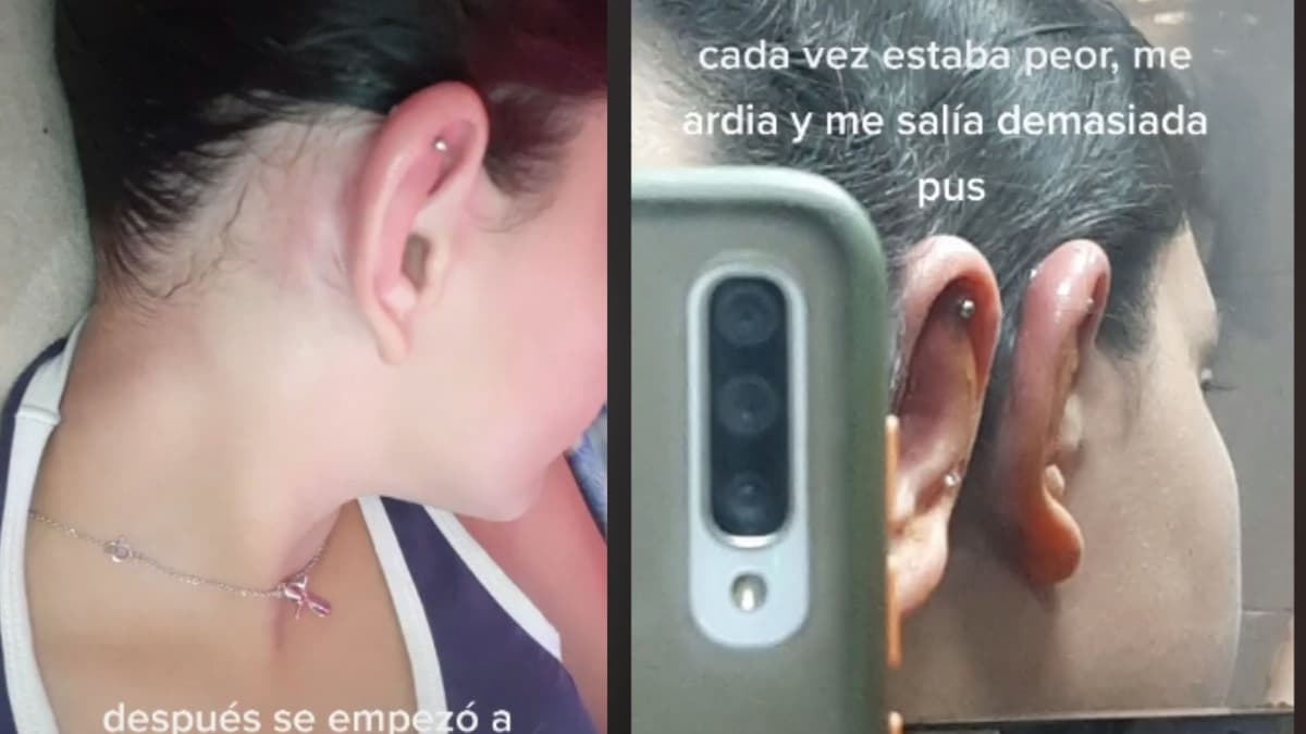 Video: Joven pierde parte de su oreja tras hacerse piercing