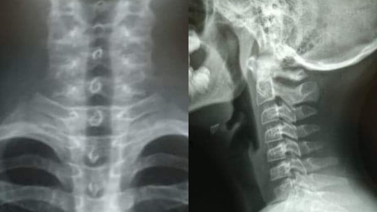 Maestro estrangula a alumno por salpicarlo con agua