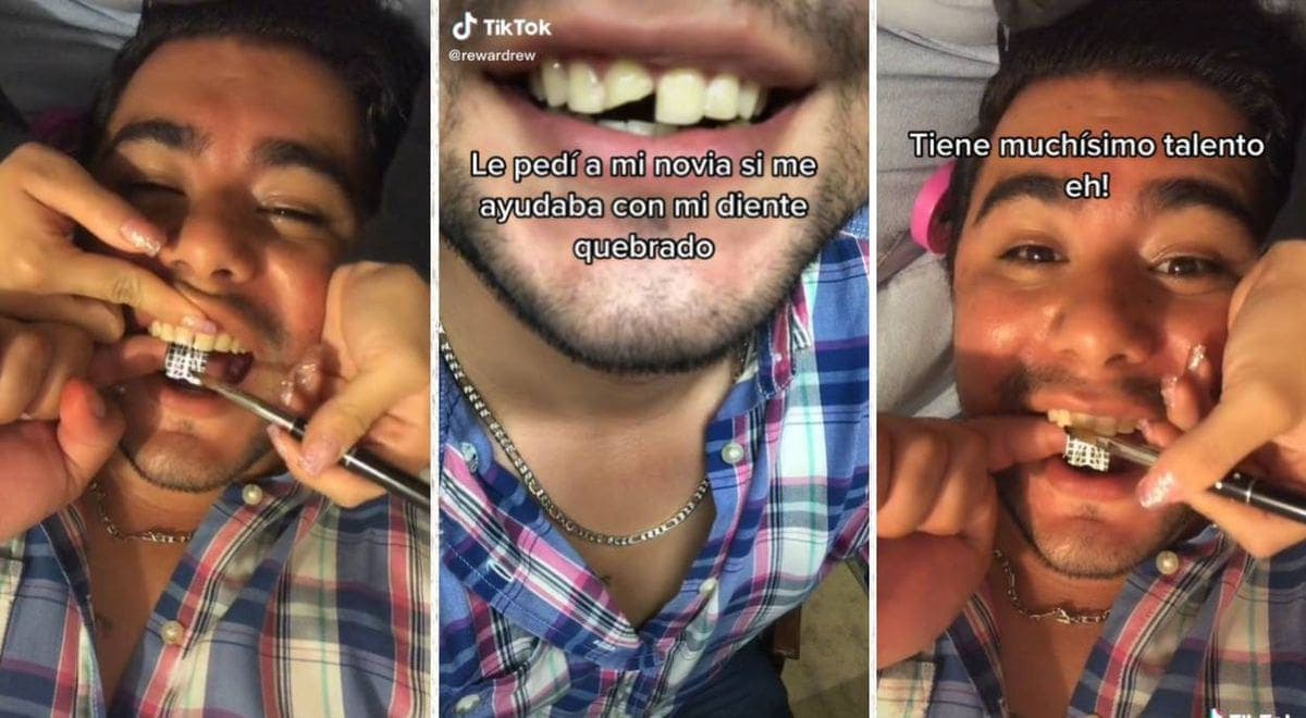 VIDEO: Joven se quiebra un diente y su novia manicurista se lo repara