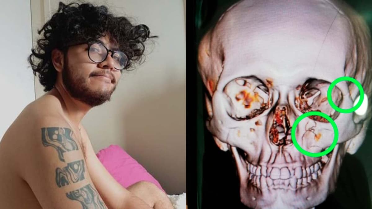 Pareja denuncia robo y agresión en bar LGBT+ de la CDMX: "Me fracturaron la cara"