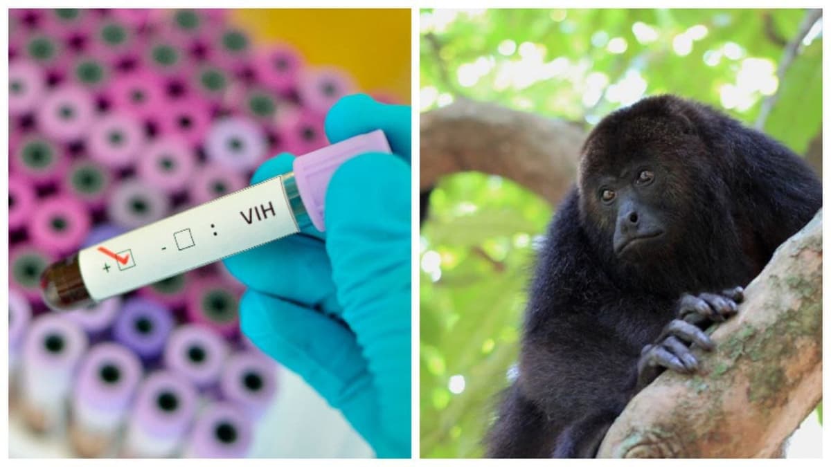 Prueban implante subcutáneo que evita infección de VIH durante 20 meses