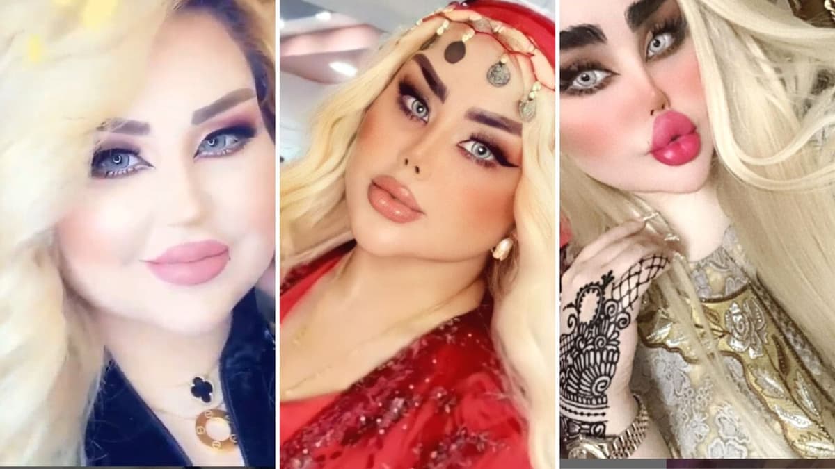 Mujer se sometió a 40 operaciones para ser la Barbie Iraquí