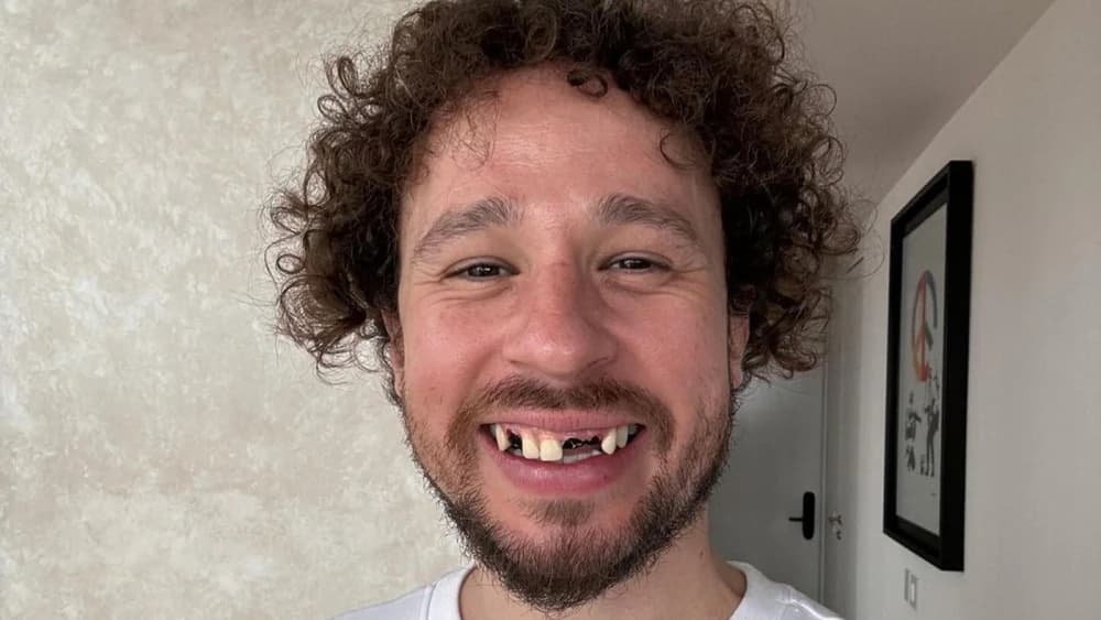 Video: Luisito Comunica no perdió ninguno de sus dientes; todo se trató de una campaña publicitaria