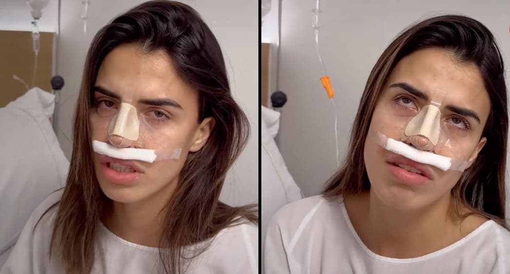 Influencer llora tras resultado de rinoplastia y usuarios le piden no hacer 'drama'