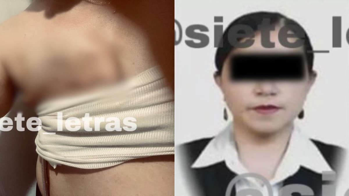 Negligencia médica: Doctora inyecta formol en lugar de anestesia y paciente pierde seno