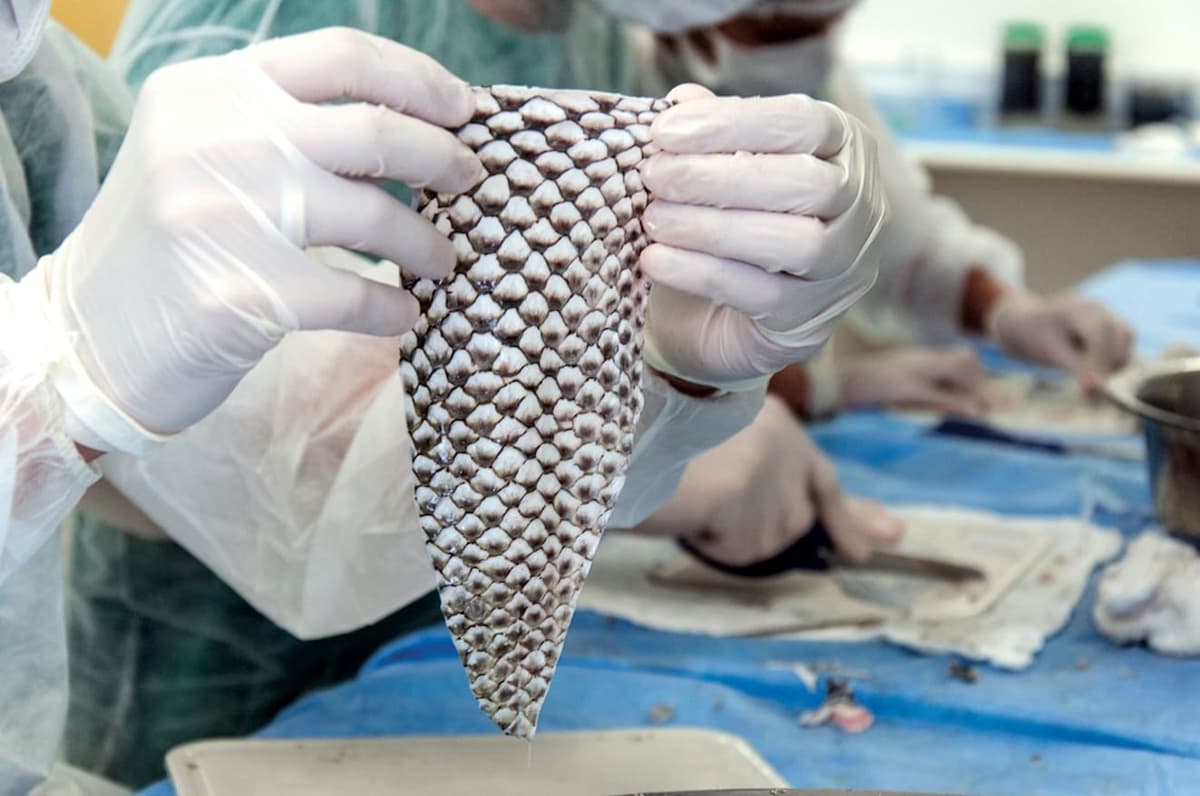 Video: Tiene la piel de tilapia propiedades antiinflamatorias y antibacterianas