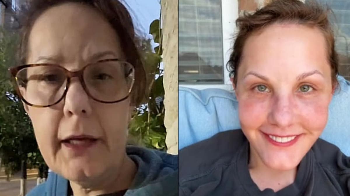 Video: Mujer de Estados Unidos viaja a México para someterse a cirugía facial y sorprende al lucir 30 años más joven