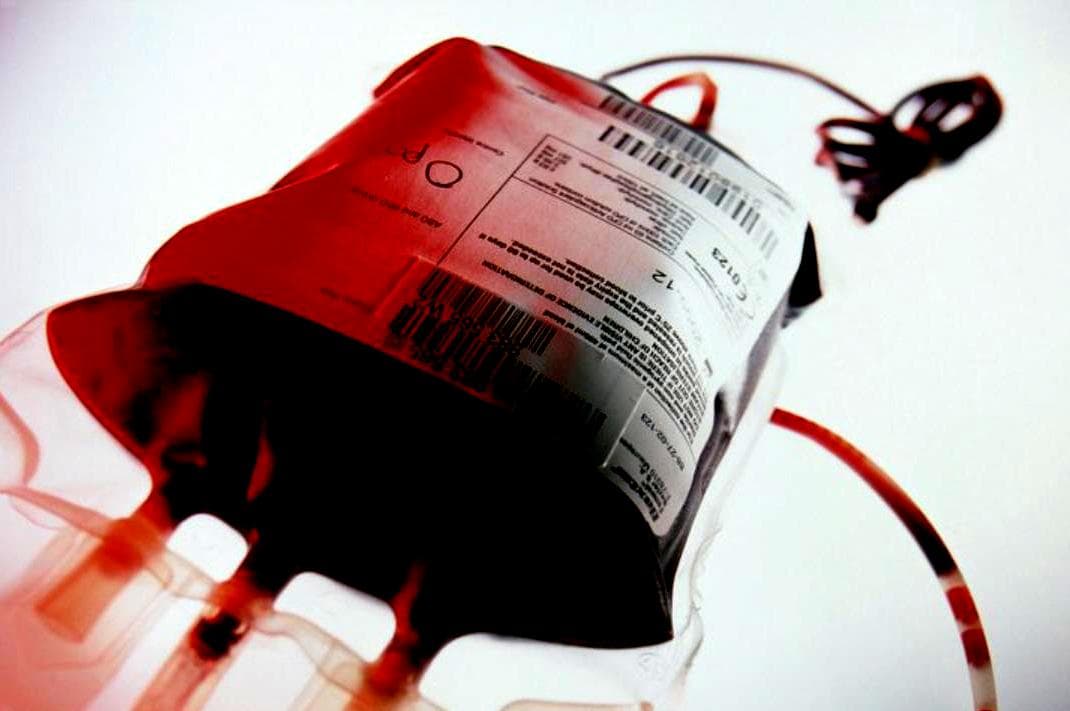 Piden donantes de sangre para Moisés, un pequeño guerrero que lucha contra el cáncer