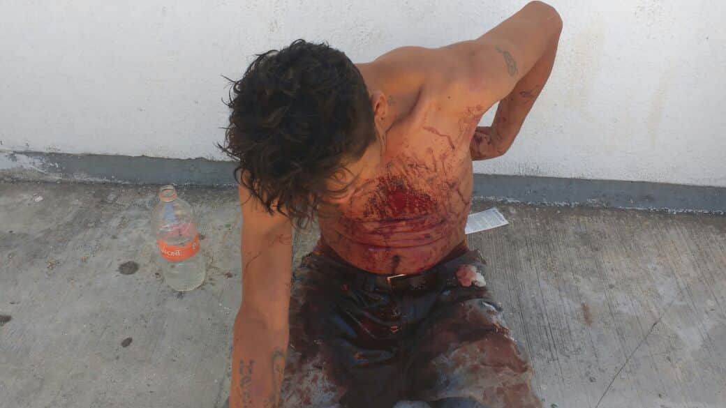 Denuncian supuesta golpiza de policías en Chetumal