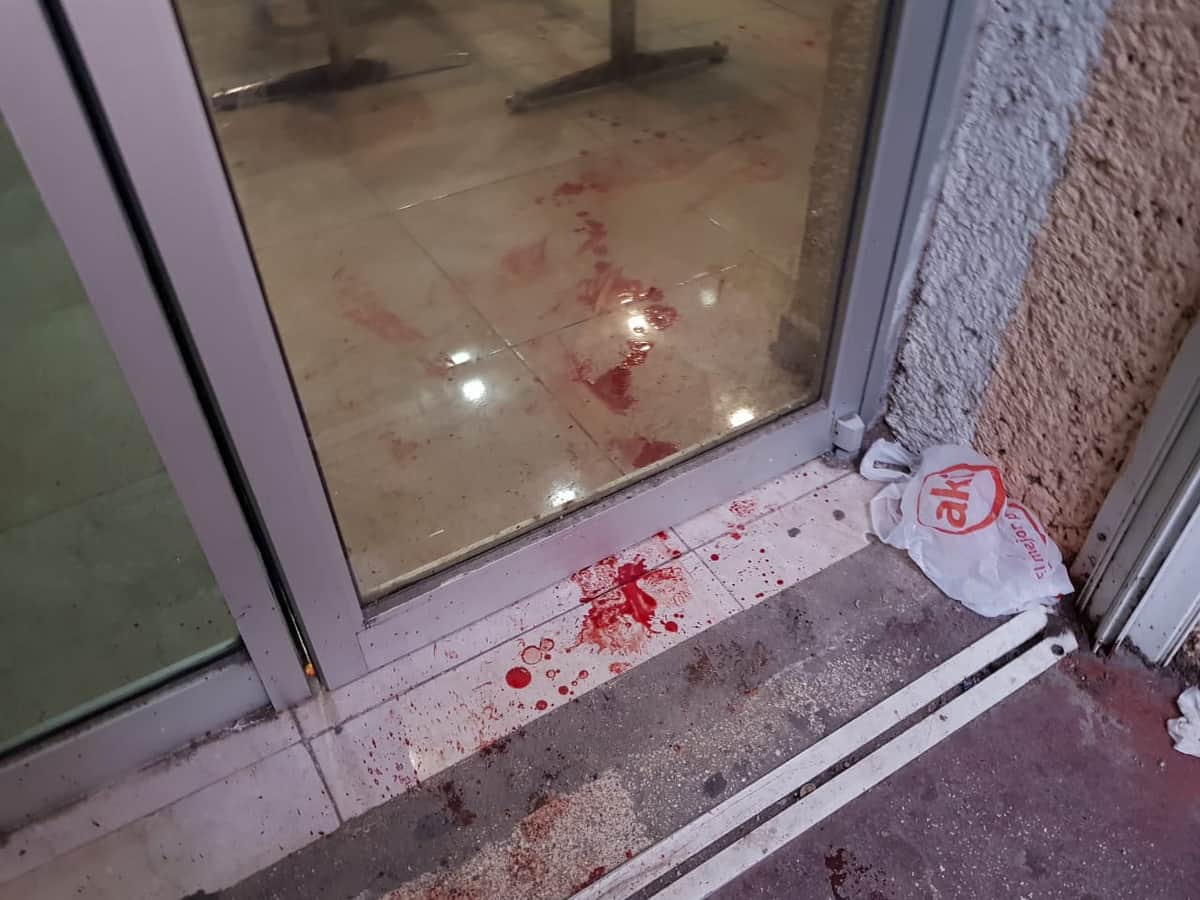 Le disparan y llega caminando al hospital