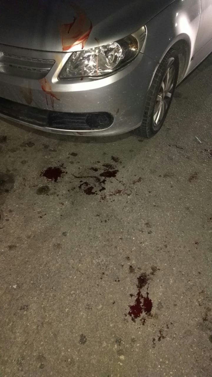 Lesionan con machete a un hombre en Chetumal