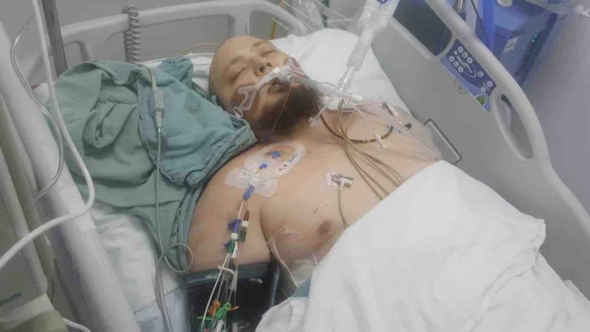 Muere extranjero al caerse de balcón en Iberostar Playa Paraiso