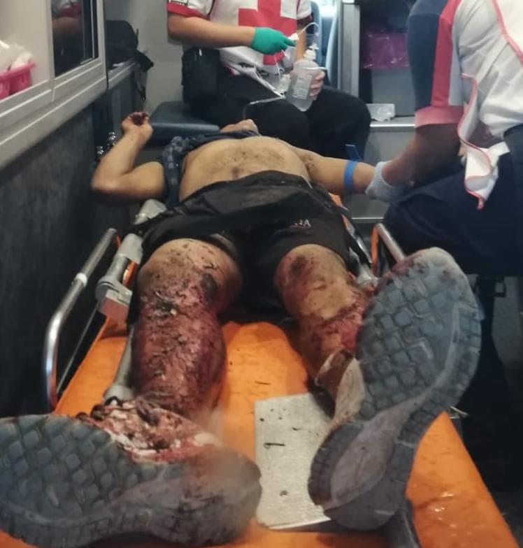 Cansado de dos robos, en la tercera recibió al ladrón a balazos, en Chetumal