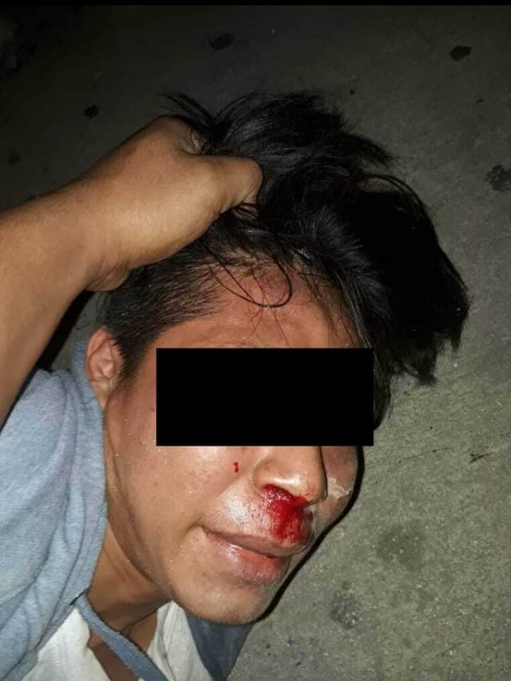Golpean a asaltante en Villas Otoch Paraíso