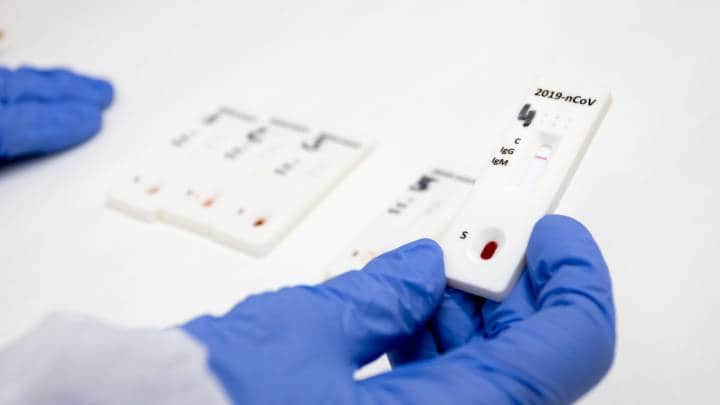 Conoce el calendario para aplicar las pruebas rápidas Covid-19 en Solidaridad