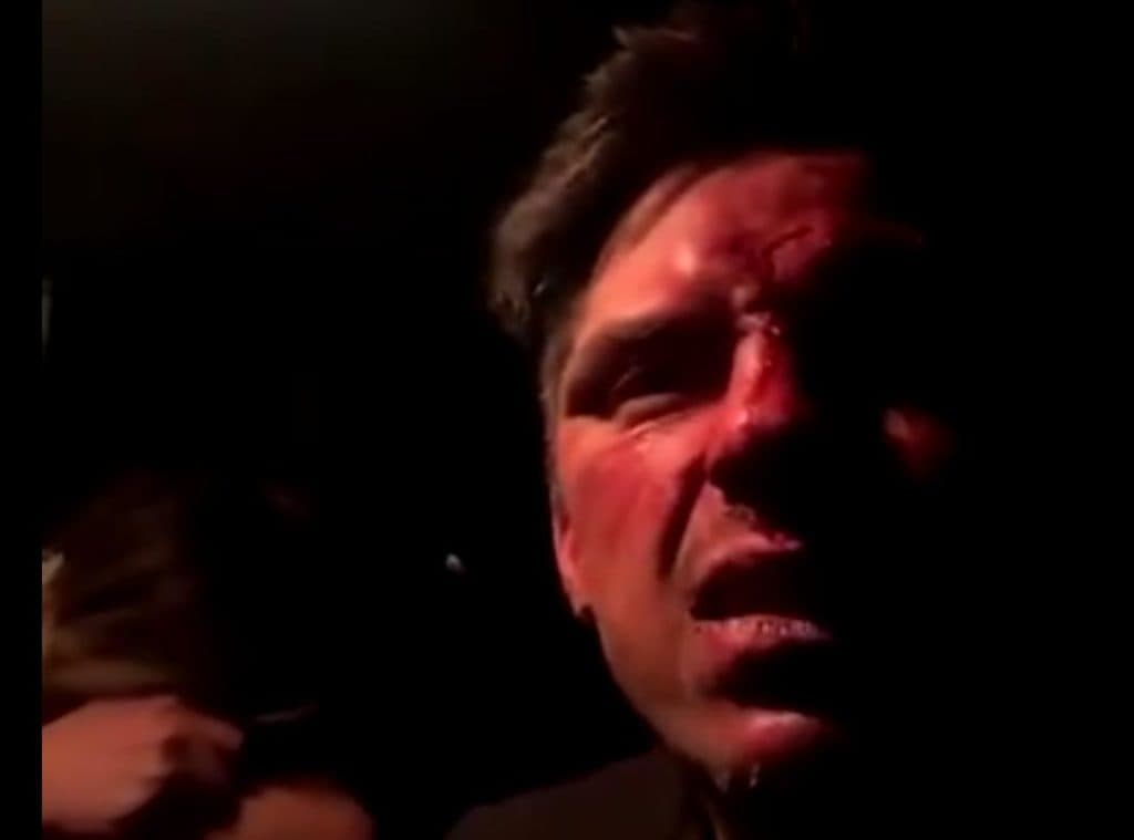 Hijo de Lupita D'Alessio acusa a primo de EPN de golpearlo y amenazarlo de muerte