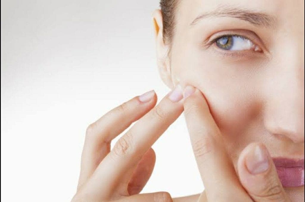 Por exprimirse un grano, una adolescente se desfigura la cara y se vuelve viral