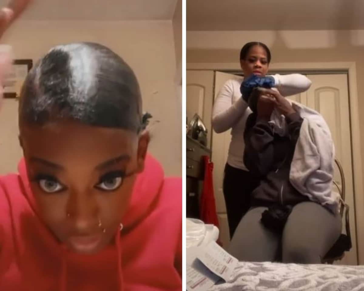 Mujer usa pegamento en vez de laca para su cabello, la hospitalizan por tener un mes sin poder quitarlo