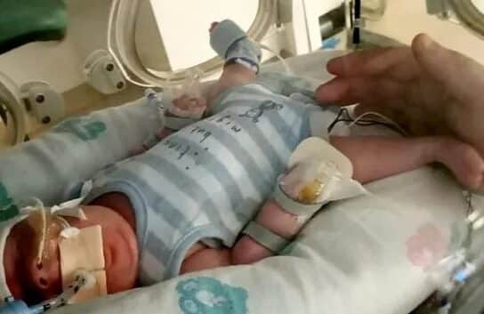 Bebé prematuro de 765 gramos venció al Covid y luego una infección intestinal