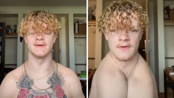 Un joven nació sin clavículas, fue discriminado y ahora busca hacerse famoso