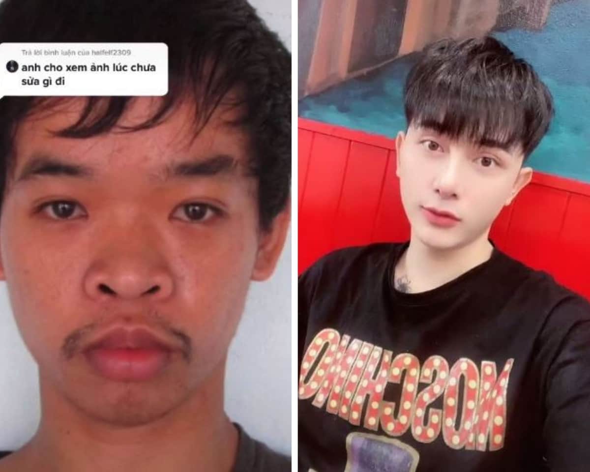 Video: No le daban trabajo por "feo", se opera el rostro y luce irreconocible