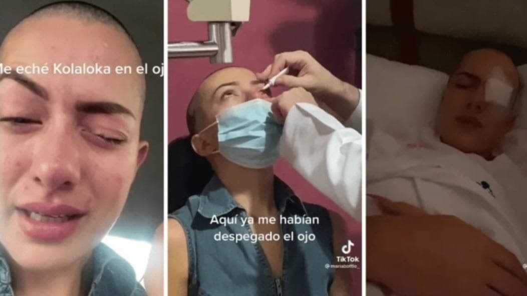 Influencer confunde Kola Loka con sus gotas ¡y se pega los párpados!