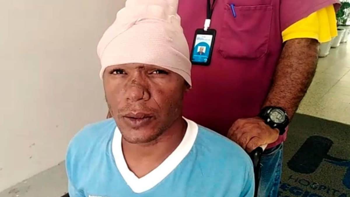 ¡Increíble! Médicos salvan a hombre que se incrustó un clavo en la cabeza
