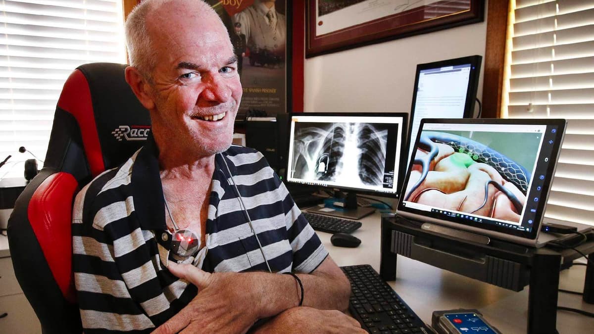 ¡Increíble! Hombre con esclerosis publica primer tuit de la historia escrito "solo con la mente"