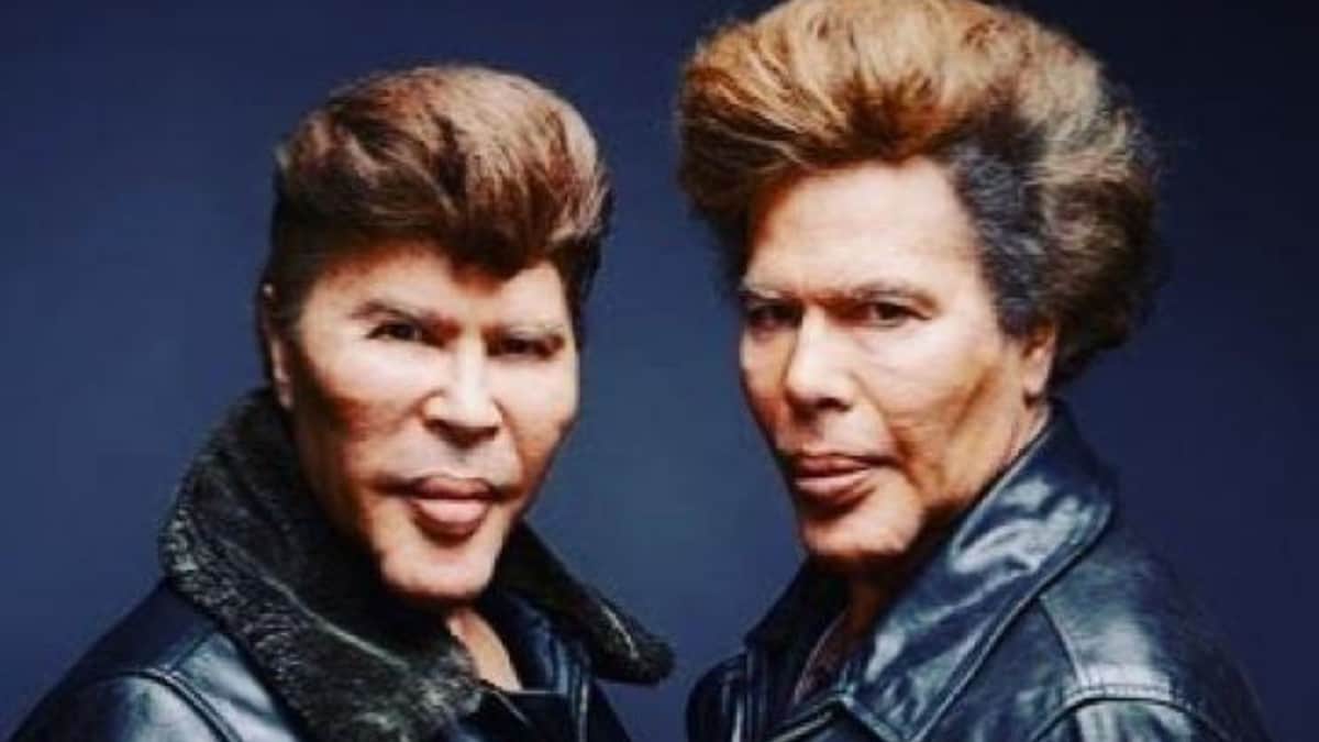 Mueren por Covid los gemelos más famosos del mundo; eran antivacunas