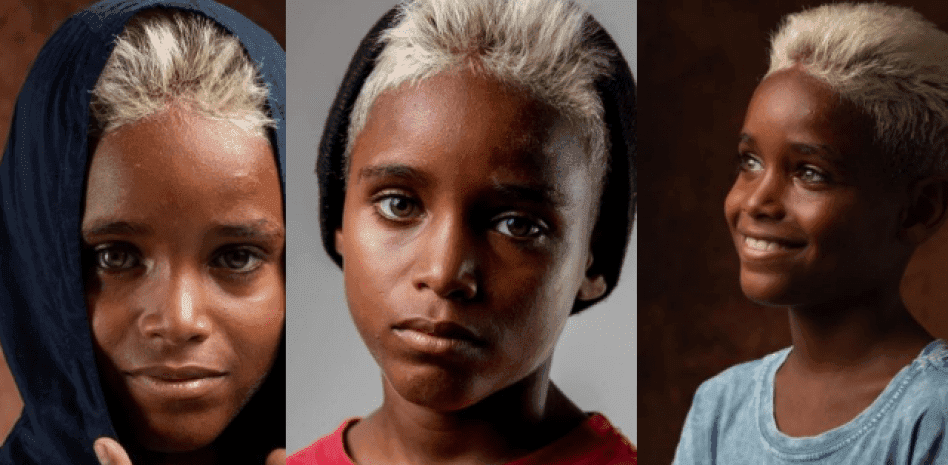 FOTOS: Niño que vive en una choza de madera, arrasa con sus fotos como modelo