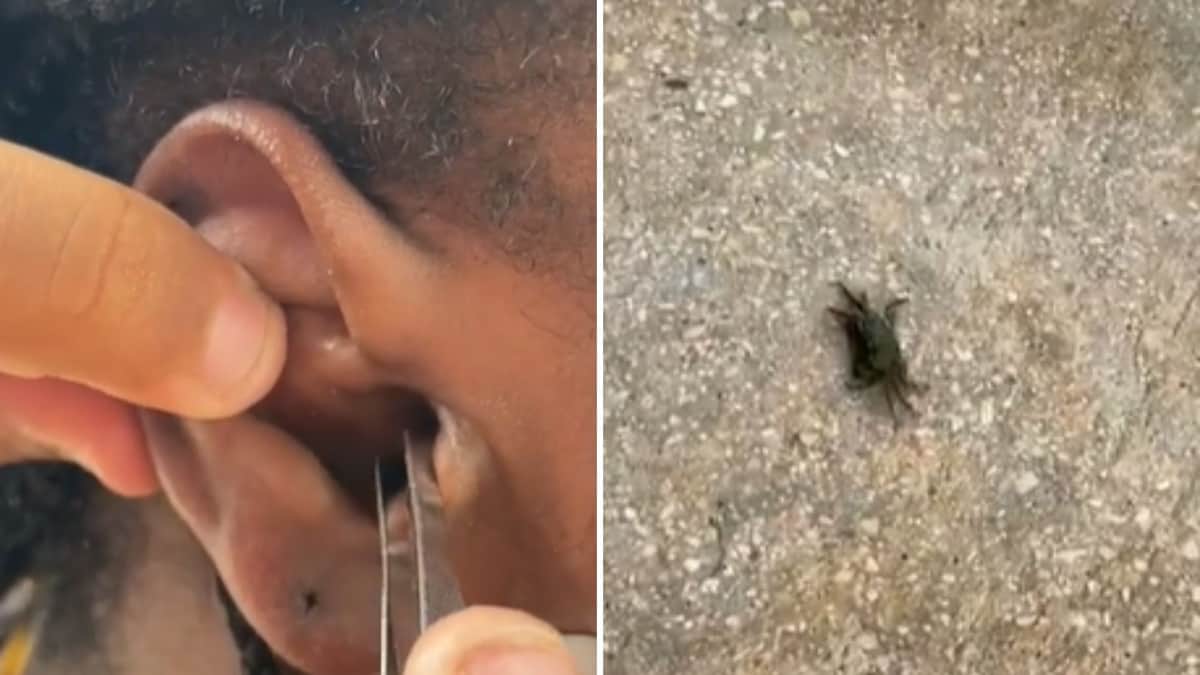 VIDEO: Cangrejo entra en el oído de turista mientras buceaba y llora de dolor al momento de sacarlo