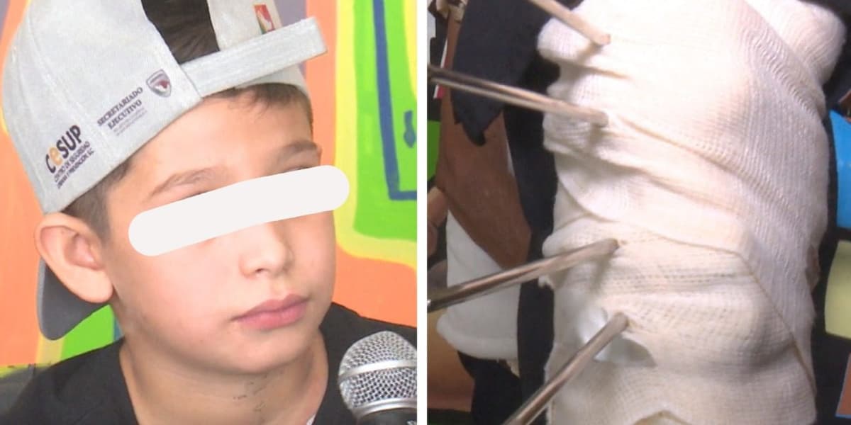 Niño que saltó para acariciar a un lobo canadiense y que le mordió el brazo ya se recupera