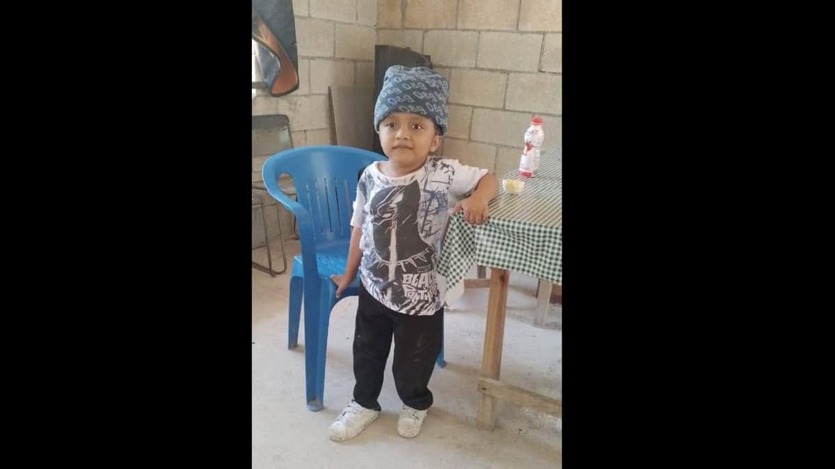 Padres de Tihosuco piden ayuda para costear cirugía de hijo, en riesgo de muerte