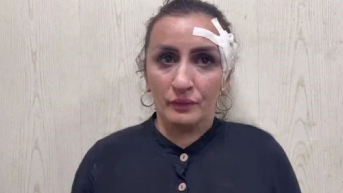 Madre vende a su hijo recién nacido para operarse la nariz