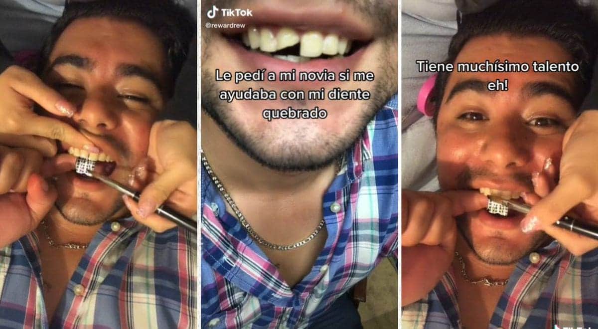 VIDEO: Joven se quiebra un diente y su novia manicurista se lo repara