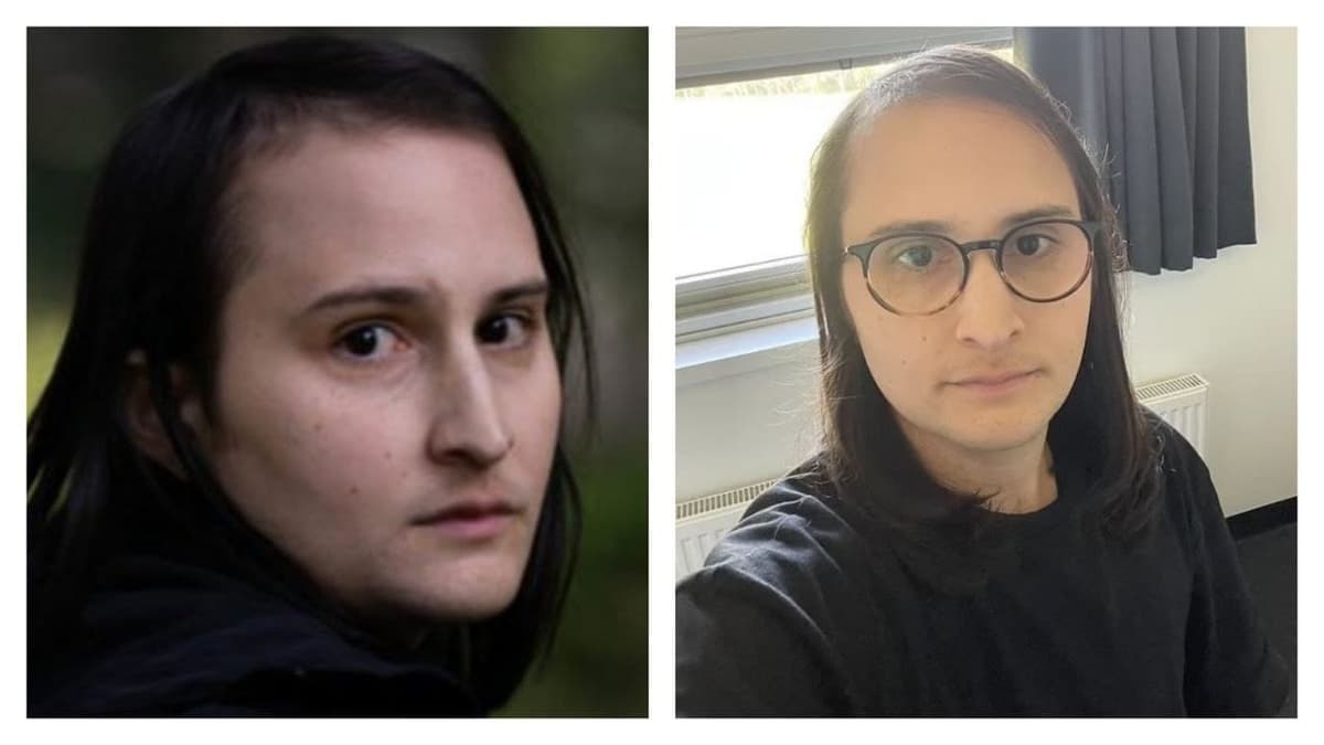 Mujer cambia de sexo, se arrepiente y demanda a psiquiatra que aprobó su tratamiento hormonal