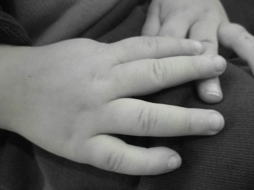 Acusan a sujeto de maltrato infantil en Puebla tras quemar las manos de su hija en un comal